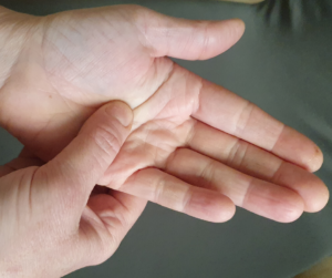 hand solar plexus reflex